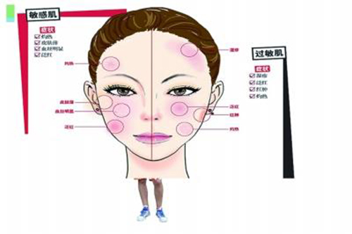 护肤不当发红用什么乳膏,护肤不当发红怎么办