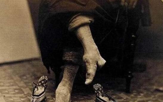 古代女子缠足对生活的影响,古代女人缠脚有哪些好处