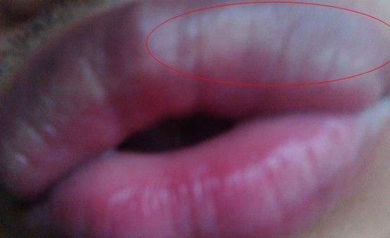 中医养生调理唇色怎么样,中医养生之道如何从唇色看健康