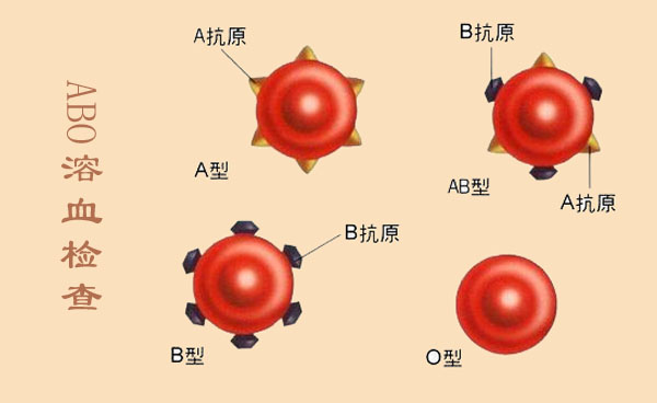 备孕必做检查准爸准妈千万别轻忽,孕前优生优育检查项目有哪些