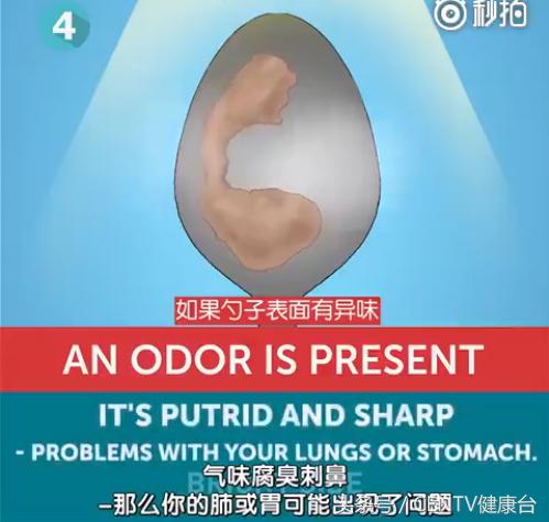 一个勺子，花一分钟知道你身体好不好