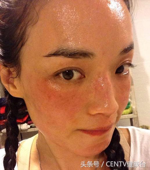 舒淇过敏化妆视频教程,舒淇皮肤敏感恢复