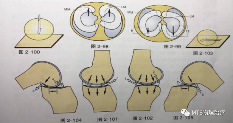半月板撕裂,半月板资料
