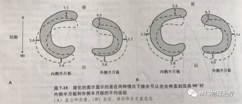 半月板撕裂,半月板资料