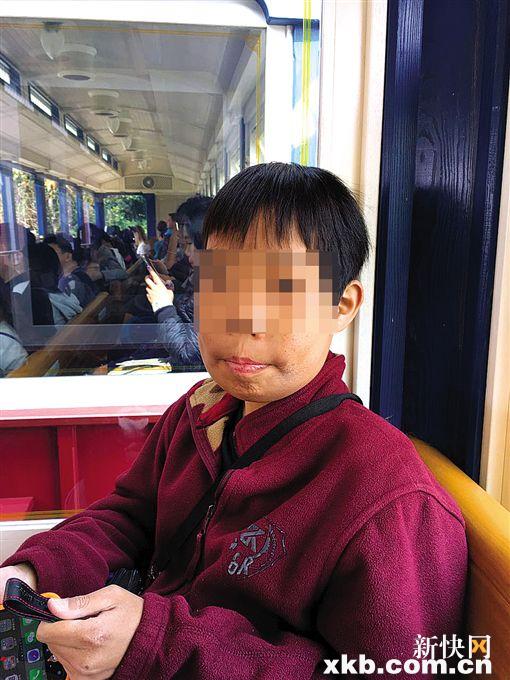 目前地贫患儿存在的困难有哪些,地贫儿童救助