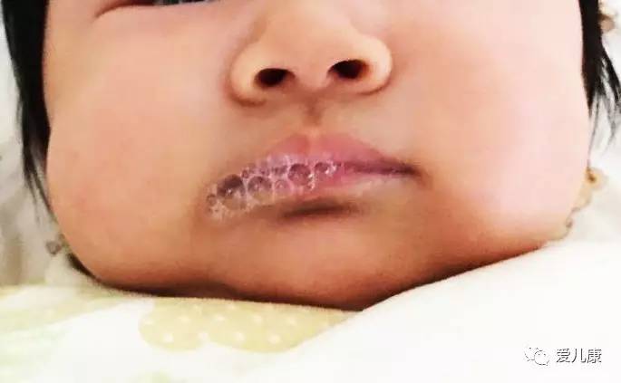 宝宝像小鱼吐泡泡一样,宝宝像大人一样吐怎么回事