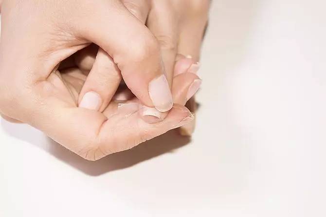 指甲从根部断裂去除断甲,指甲断裂在家自己怎么修补