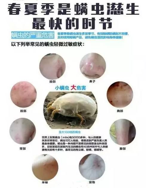 小一点的螨虫怎么消除,小螨虫最怕什么药