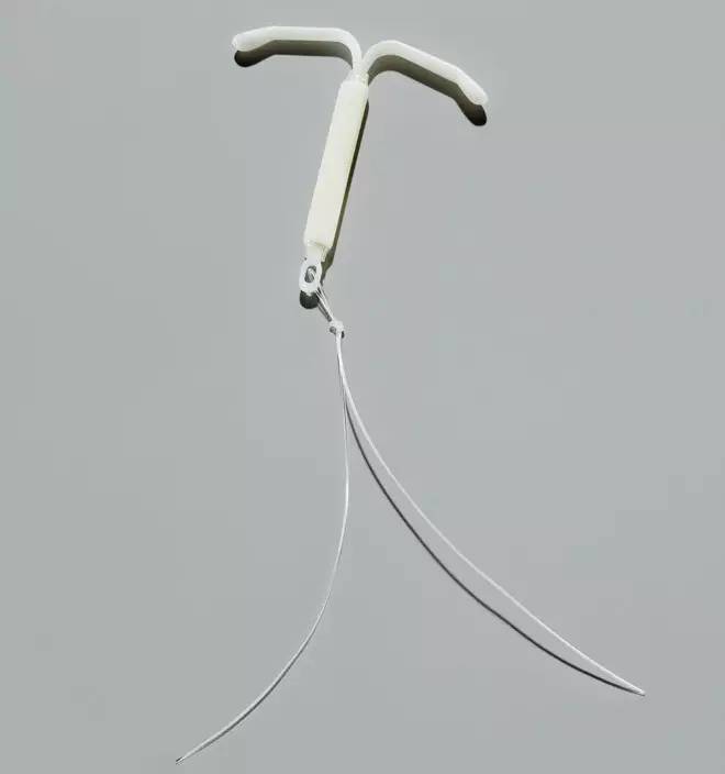 宫内节育器的扭曲历史,宫内节育器移位案例