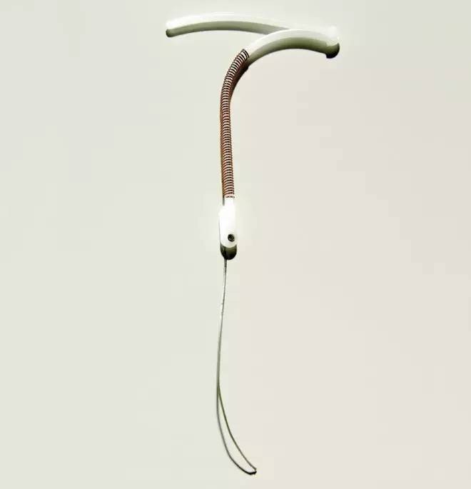 宫内节育器的扭曲历史,宫内节育器移位案例