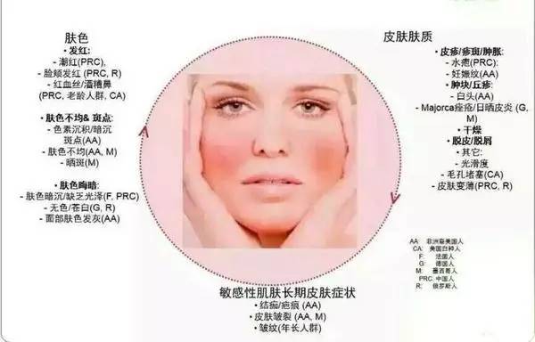 敏感肌肤红血丝怎么修复皮肤屏障,敏感肌肤红血丝用什么修复