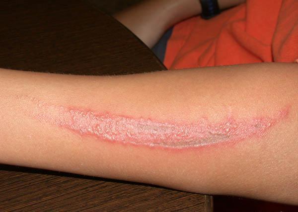 夏天来了家里的虫子好多怎么办,夏天要来了谨慎蚊虫