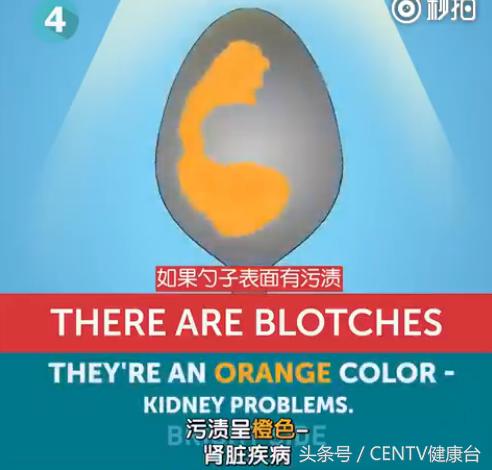 一个勺子，花一分钟知道你身体好不好