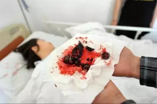 升降椅一秒变*弹炸**！你还敢坐吗？