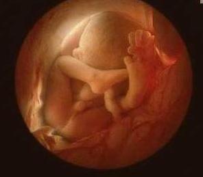 孕妇大意导致胎儿畸形,孕妇怀着双胞胎宝宝忽然羊水破了