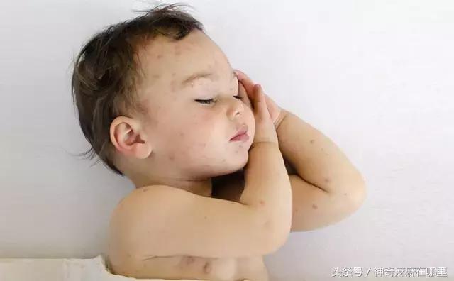 幼儿怎么选驱蚊液用得快,给宝宝驱蚊用什么安全又有效