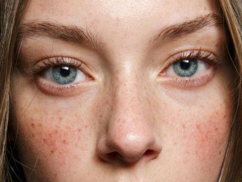 修复红血丝,眼睛痒有血丝还很红用什么眼药水