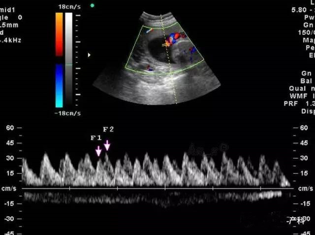 准妈妈孕检记录单,准妈妈血液检测