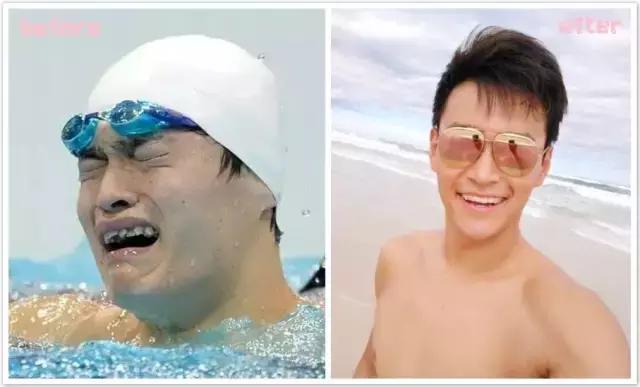 孩子牙齿畸形怎么办,小孩子牙畸形怎么办