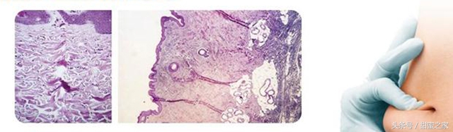世界最前沿治糖尿病科技,世界最新糖尿病医学突破