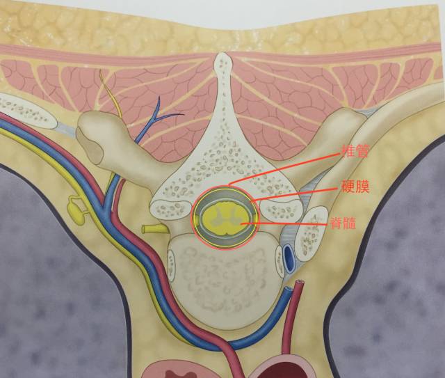 腰腿疼是椎管肿瘤吗,腰腿疼痛需要关注脊髓肿瘤吗