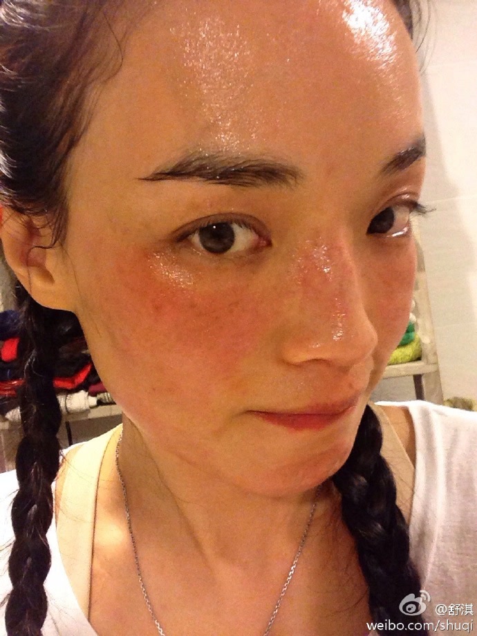 舒淇过敏修复方法,舒淇敏感肌自救方法