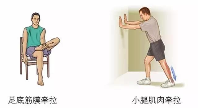 足底筋膜炎怎么治,足利芙能不能治足底筋膜炎