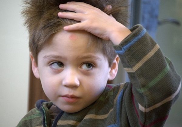 小孩不谨慎撞到人了怎么处理,小孩子撞到头会发烧吗