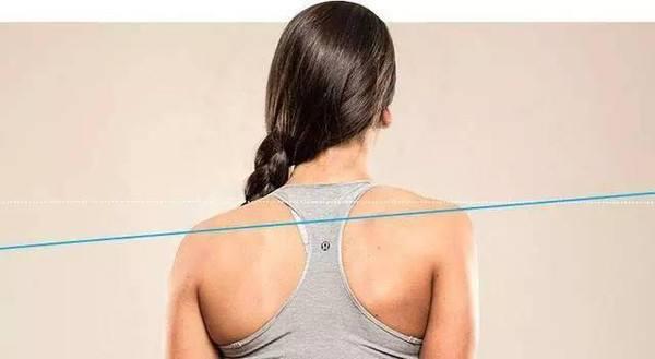 脊柱侧弯治疗最有效最快的办法,脊柱侧弯治疗有几种方法