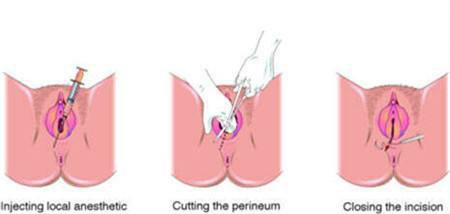 孕妈分娩时一定要关注这几个事项,孕妈产前需要了解的知识