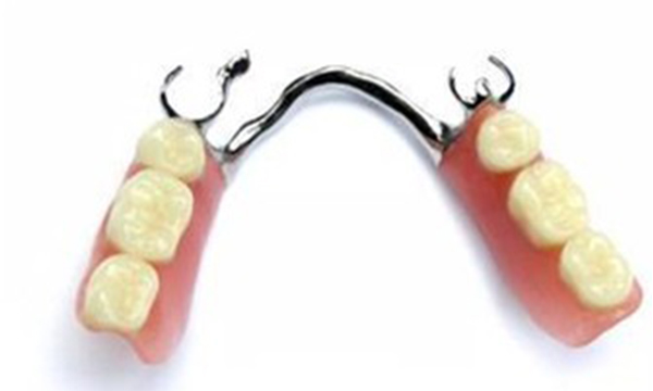 牙齿掉了一颗镶牙要多少钱,最后一颗牙齿掉了怎么镶牙