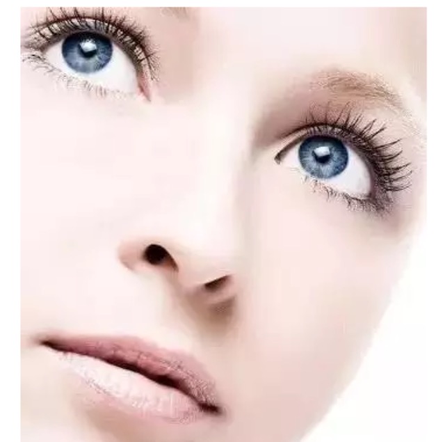 和阿姨的双眼皮做的太宽失败了