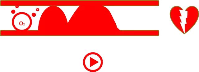 心绞痛在病情发作的时候如何自救,心绞痛和心肌梗塞的症状和区别