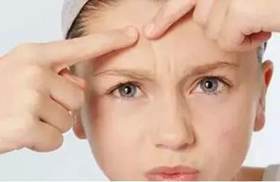 用粉刺针挑粉刺好吗,粉刺针挑痘正确使用方式