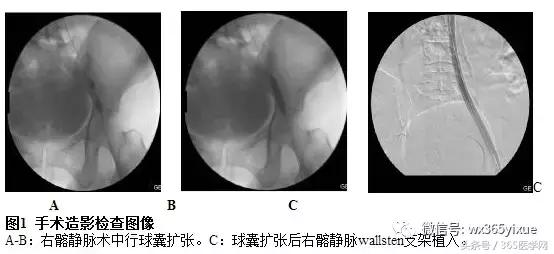 黄陂区中医院骨科金志宏,血管外科金志宏