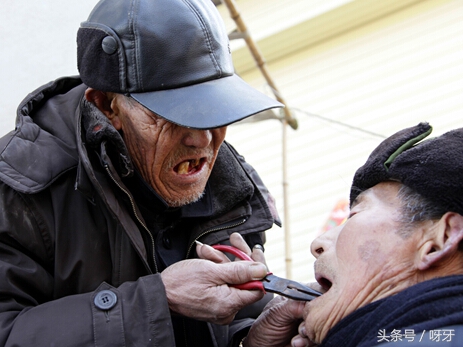 长出来的智齿真的有必要拔吗,智齿已经长出来了拔除难度大吗