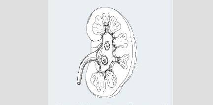中医虚寒症有哪些,冬病夏治知识大全