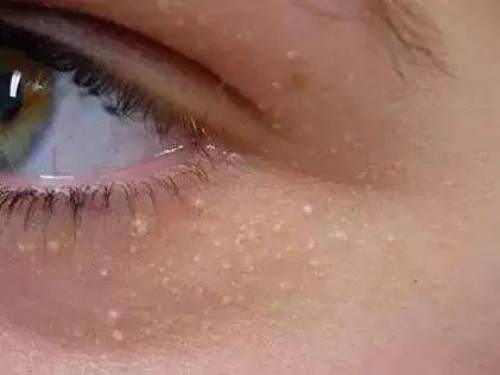 护肤问答每天解决一个小问题,护肤小课堂你知道肌肤也会劳累吗