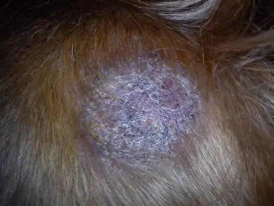 人传染了猫癣还会传染给其他人吗,得了猫癣会烂哪里