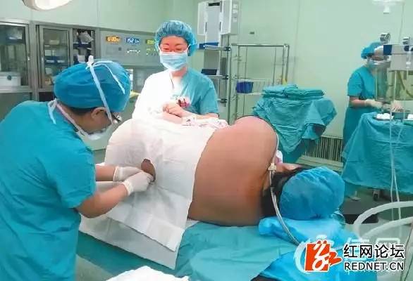 深度好文：母亲节即将来临，说说女人生孩子那点事