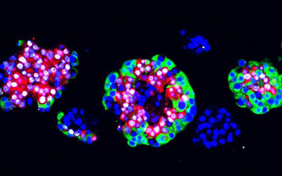 2020第十一届细胞治疗国际研讨会,第八届亚太医学与肿瘤论坛
