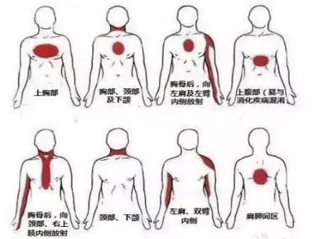 心绞痛在病情发作的时候如何自救,心绞痛和心肌梗塞的症状和区别