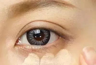 色斑暗沉没有光泽,遮不掉的黑眼圈祛不掉的痘印