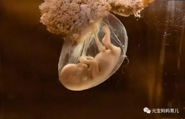 羊水早破孕妈会有什么感觉,羊水破了什么症状宝妈