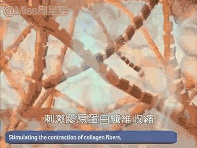 提拉紧致抗衰老美肤仪,提拉紧致美容仪效果最好的