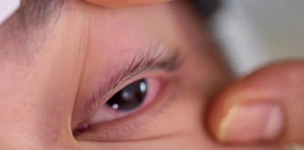 吸入笑气气体有什么危害,笑气的化学成分及其危害