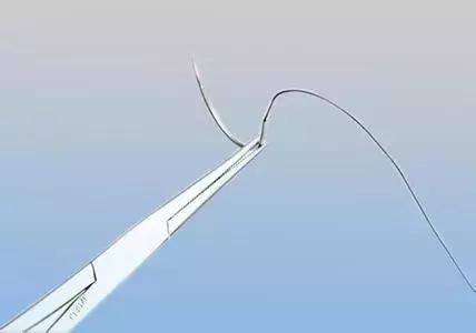 被动物咬伤了怎么办安全教案,被动物咬伤怎么办安全教育