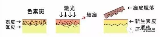 提拉紧致抗衰老美肤仪,提拉紧致美容仪效果最好的