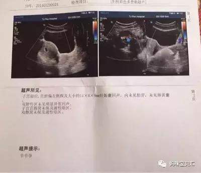 孕期几次b超比较合适,孕期B超应该多久做一次