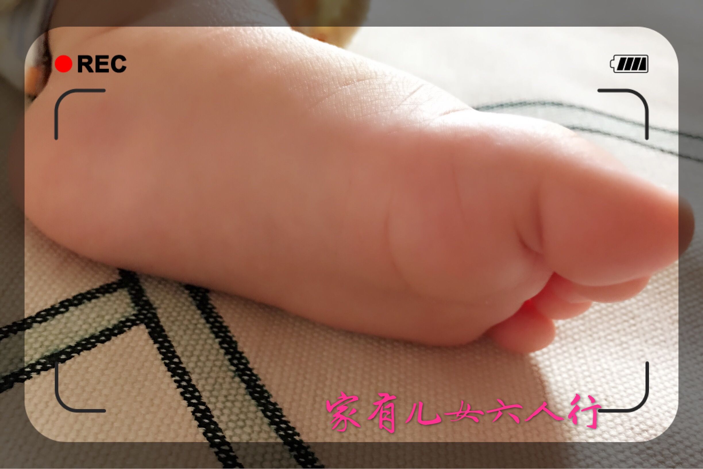 生孩子顺产转剖腹产全记录,我的生产经历